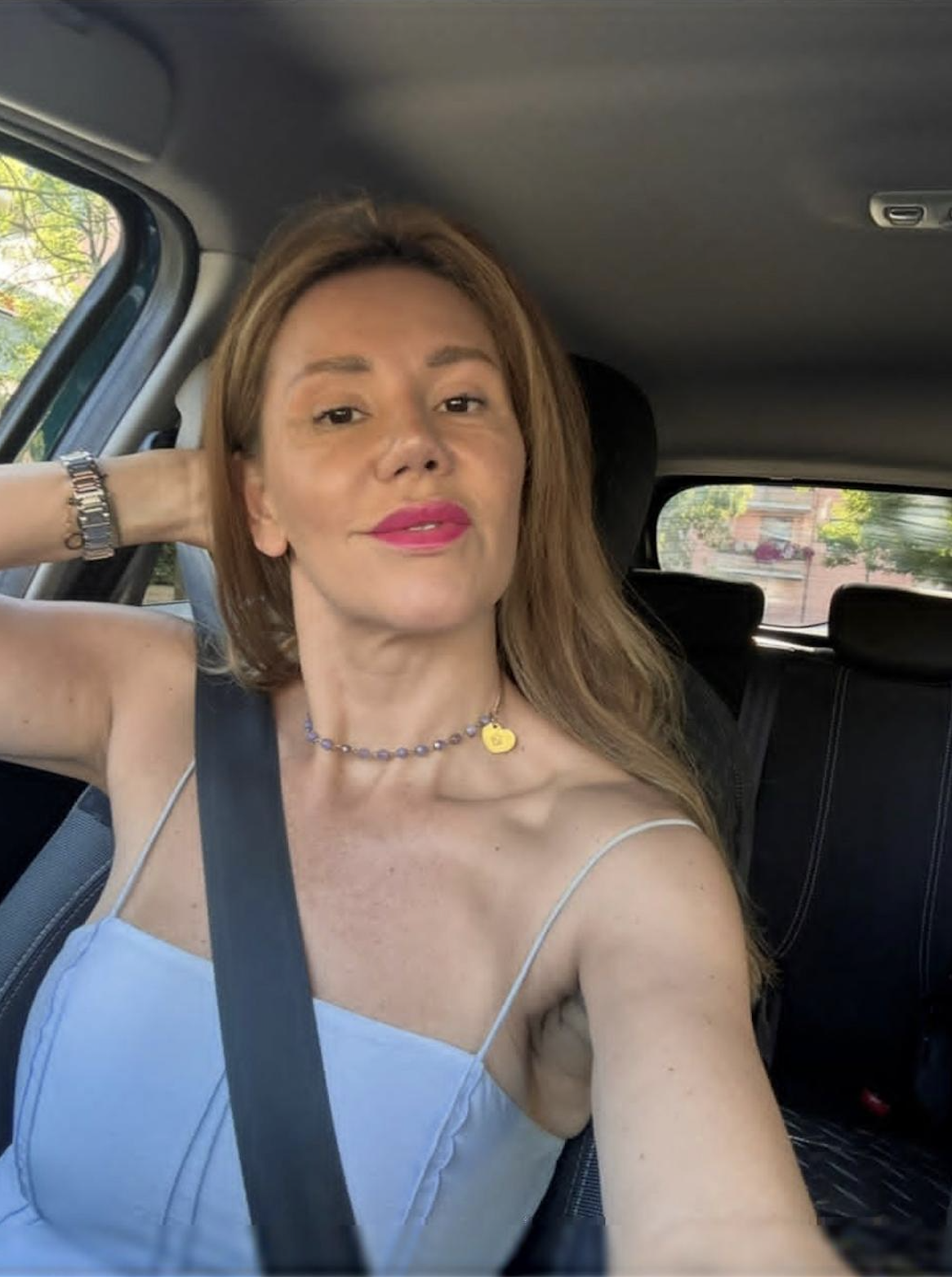 Michelle after, smoother and more rested-looking skin